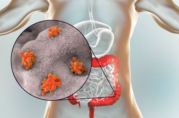tipos de parasitas no corpo humano