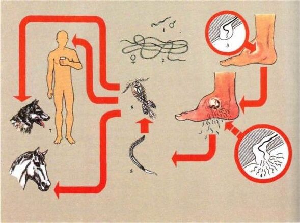 Desenvolvimento de dracunculíase