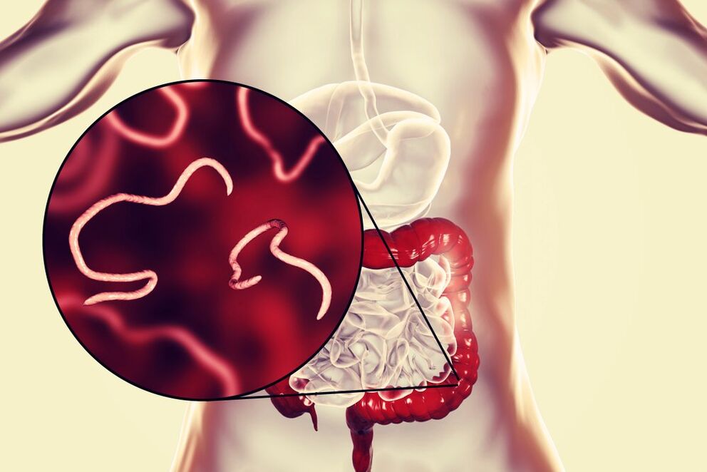 vermes no intestino humano